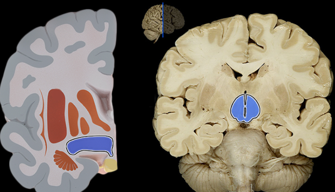 <p>Location:</p><ul><li><p>Ventral diencephalon</p></li></ul><p>Description:</p><ul><li><p>Collection of nuclei located inferior to thalamus</p></li><li><p>Includes infundibulum and mammillary bodies</p></li></ul><p>Function:</p><ul><li><p>Considered master control center for endocrine system</p></li><li><p>Secretes releasing and inhibiting hormones that control anterior pituitary gland</p></li><li><p>Produces hormones that are transported to and stored in posterior pituitary gland</p></li><li><p>Controls autonomic nervous system</p></li><li><p>Regulates body temperature, food, and water intake</p></li><li><p>Regulates emotional behavior</p></li><li><p>Maintains sleep/wake cycle</p></li></ul><p></p>