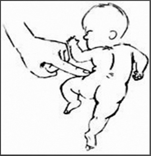 <p>This is an example of what reflex…</p>