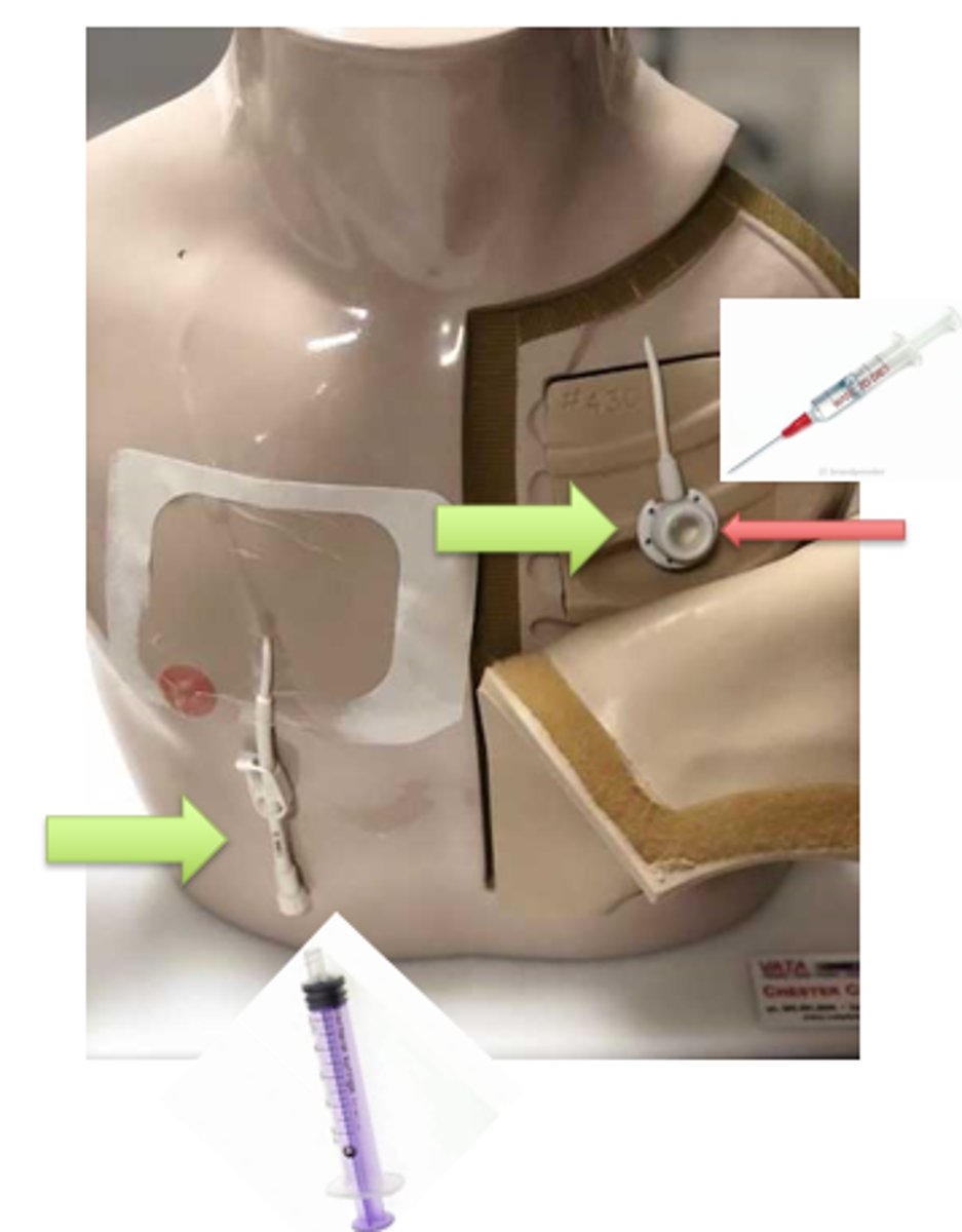 <p>VAP on R needs a _____________________ to puncture the area near red arrow, whereas VAP on L can be hooked up to a ____________________ and pushed.</p>