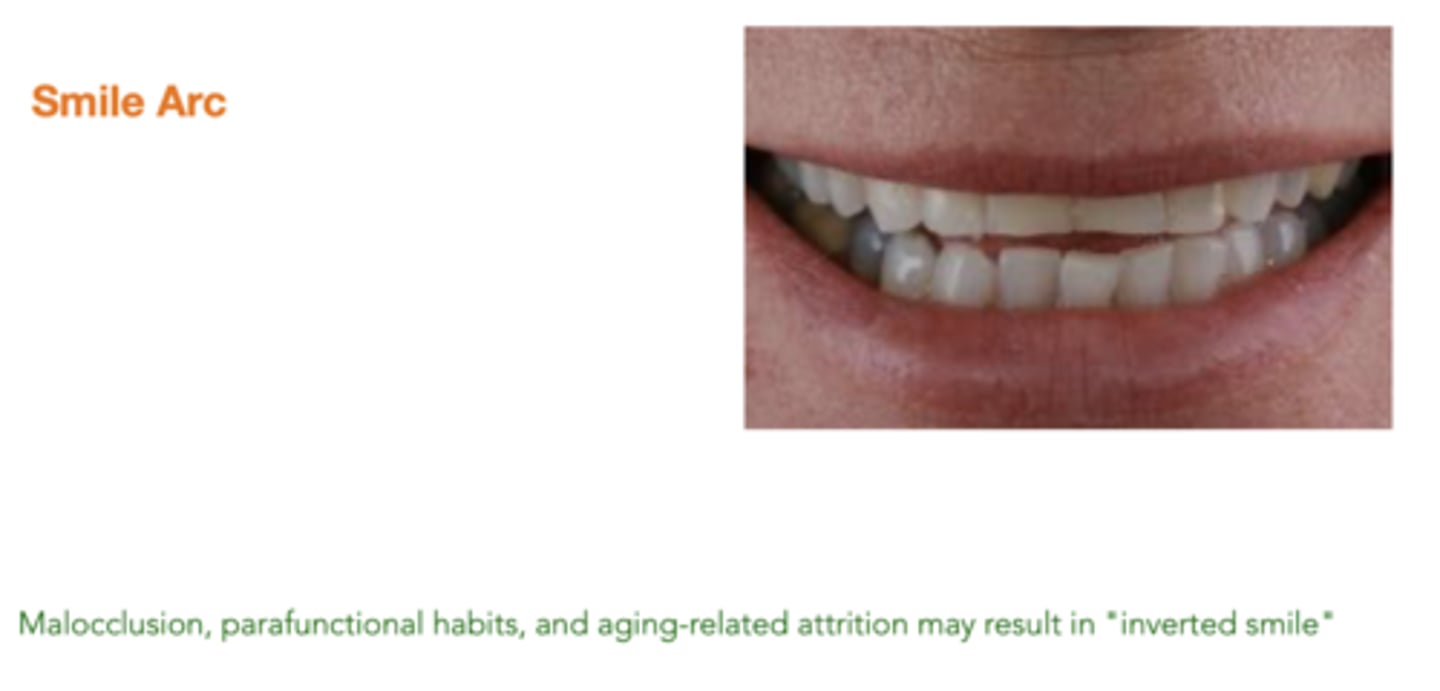 <p>inverted smile</p>