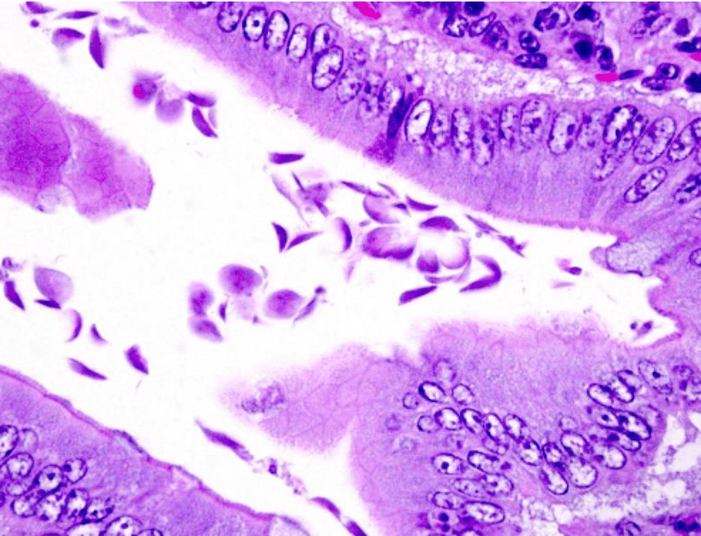<p>acortamiento de microvellosidades → ↓ superficie de absorción → malabsorción</p><p>+ acción expoliadora</p><p>+ acción vectorial: portadora de virus, bacterias, hongos, micoplasmas</p>
