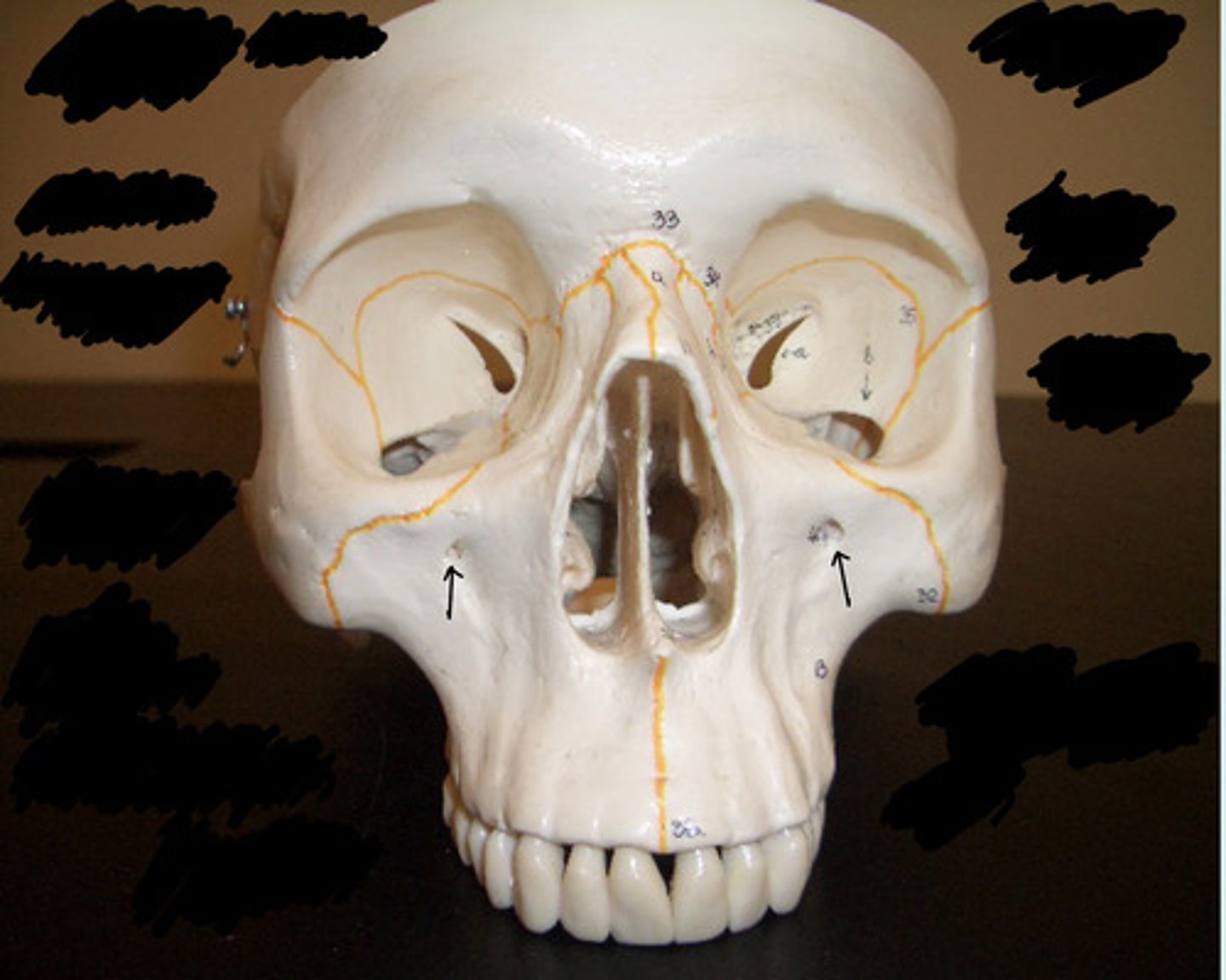 <p>What structure is pointed to here?</p>
