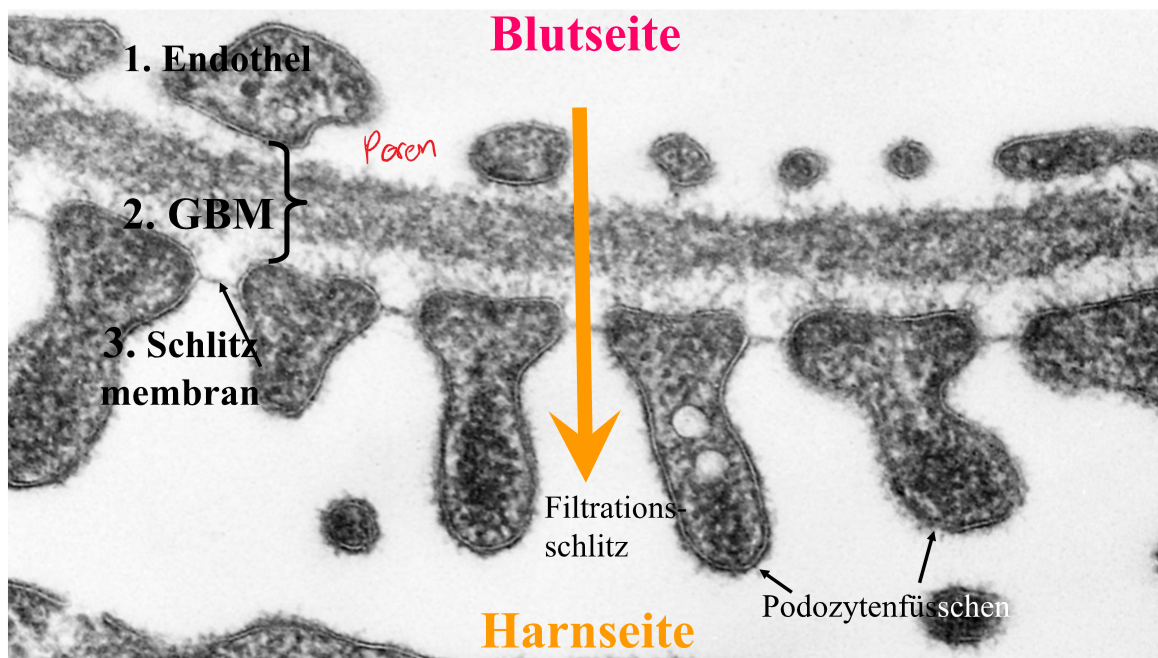 <ol><li><p><strong>fenestrierte Endothelzellen</strong></p></li><li><p><strong>glomeruläre Basalmembran</strong></p><p>→ Kollagen &amp; Proteoglykane (negativ geladen) → stossen <strong>Proteine</strong> (negativ geladen) ab → sehr wichtig um nicht zu viele Proteine zu verlieren</p></li><li><p><strong>Schlitzmembran</strong> → Podozytenfüsschen</p></li></ol>