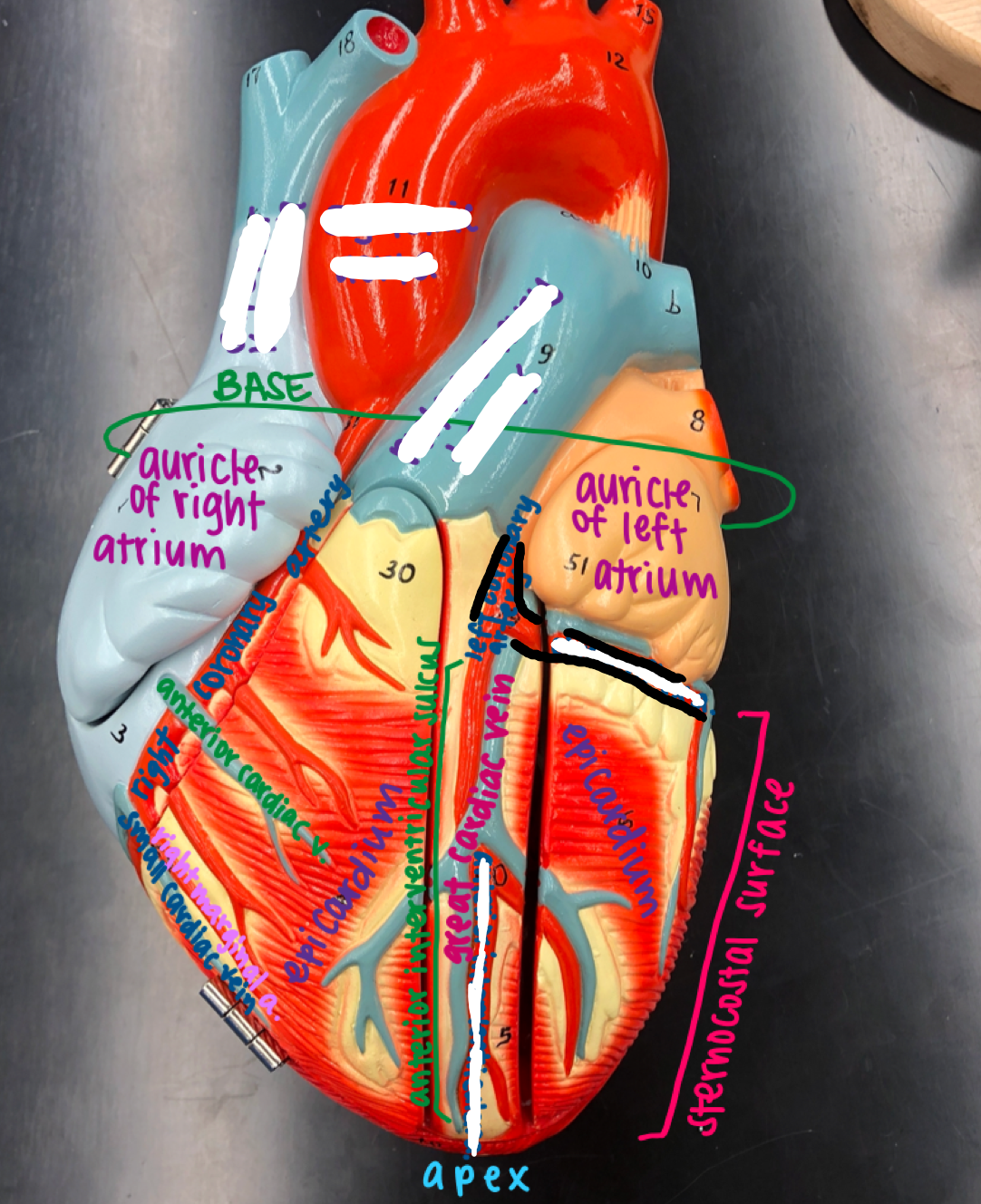 <p>The red artery lining the front of the heart underneath the auricle of the left atrium</p>