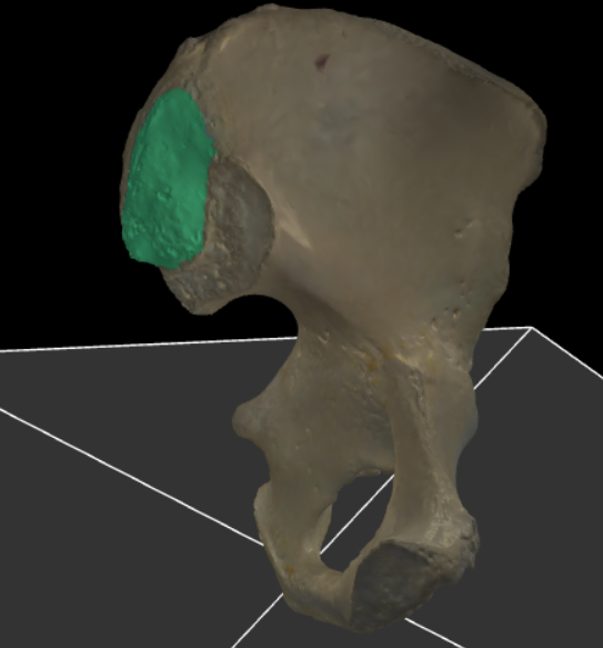 <p>Het ruwe gebied boven de facies auricularis dat dient als aanhechtingsplaats voor ligamenten.</p>
