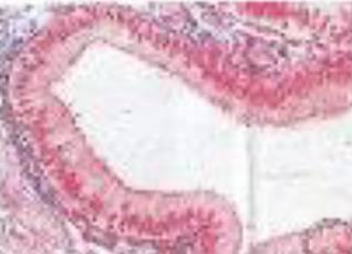 <p>Identifica el tejido</p>