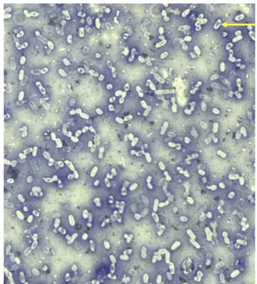 <p>- nigrosin- negative stain; shows cell shape</p><p>- basic stain- stains cell body; shows capsule thickness</p>