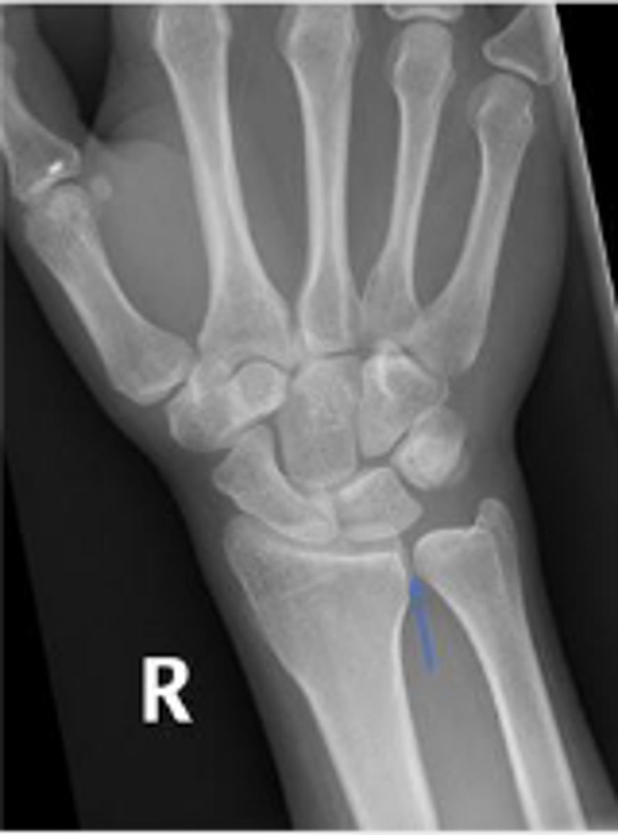 <p>What is the normal measurement of this space?</p>