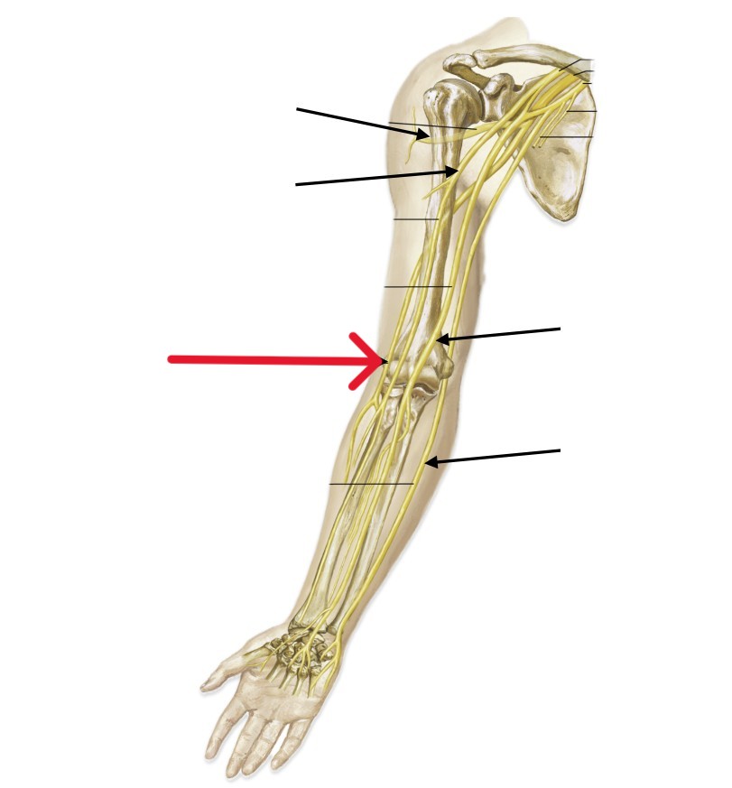 <p>Which nerve of the arm is:</p><ul><li><p>Runs on the thumb side (lateral) of the forearm</p></li></ul><p></p>