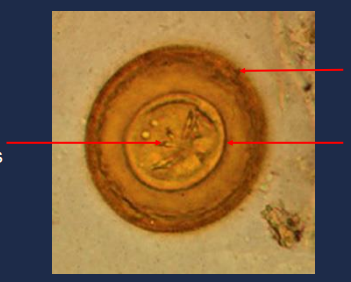 State the name of the lower right portion of the picture.