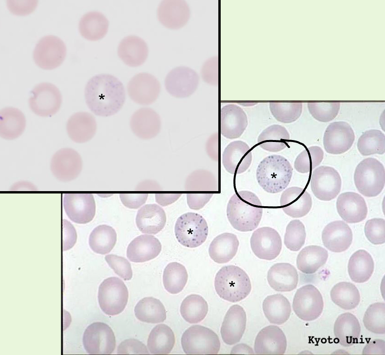 <p>What RBC inclusion is depicted in this image?</p>