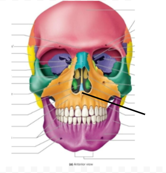 term image
