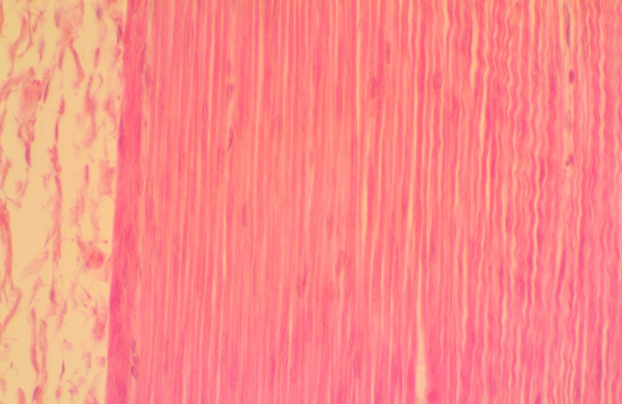 <p><span>Smooth muscles in involuntary and located in areas such as blood vessels, linings of the GI tract, &amp; urinary bladder</span></p>