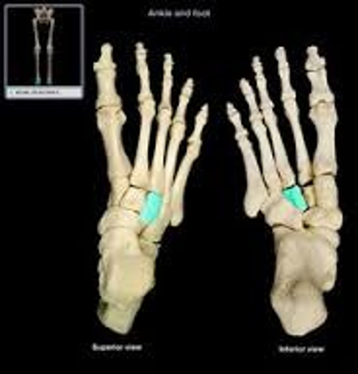 <p>Name this bone.</p>