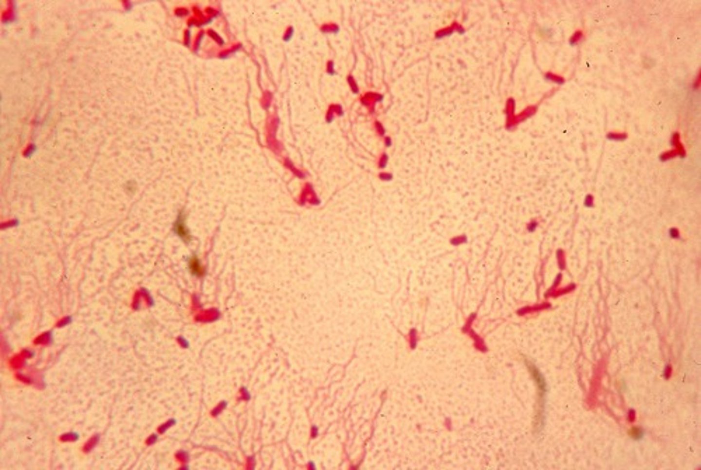 <p><strong>Pink rods (Gram-negative bacillus).</strong></p><p>Type: Bacteria (S. enterica serovar Typhi);</p><p>Disease: Typhoid fever;</p><p>Diagnosis: Blood culture early, stool/urine later; Widal test;</p><p>Treatment/Prevention: Fluoroquinolones, ceftriaxone; vaccines; sanitation;</p><p>Spread/Unique: Human-only; spreads through contaminated food/water; can hide in gallbladder (carriers).</p>