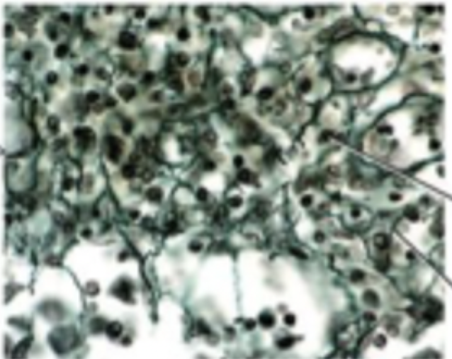 <p>3D mesh of collagen reticular fibres and reticular cells, loose ground substance</p>