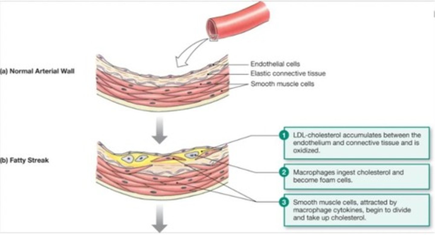 <p>HDL is considered 'healthy' cholesterol, while LDL is termed 'lethal' cholesterol due to its association with atherosclerosis.</p>
