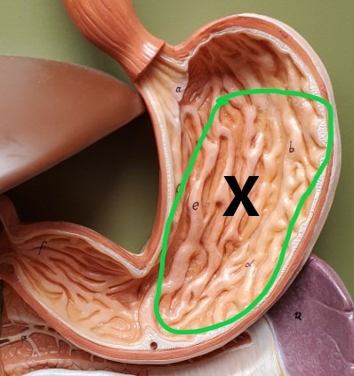 <p>ID the Region of the Stomach</p>