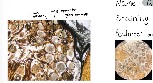 <p>Gogli apparatus</p><p>staining : silver impregnation AgNO3</p><p>features : brown network around the nucleus</p>