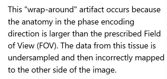 <p>B. Undersampled</p>