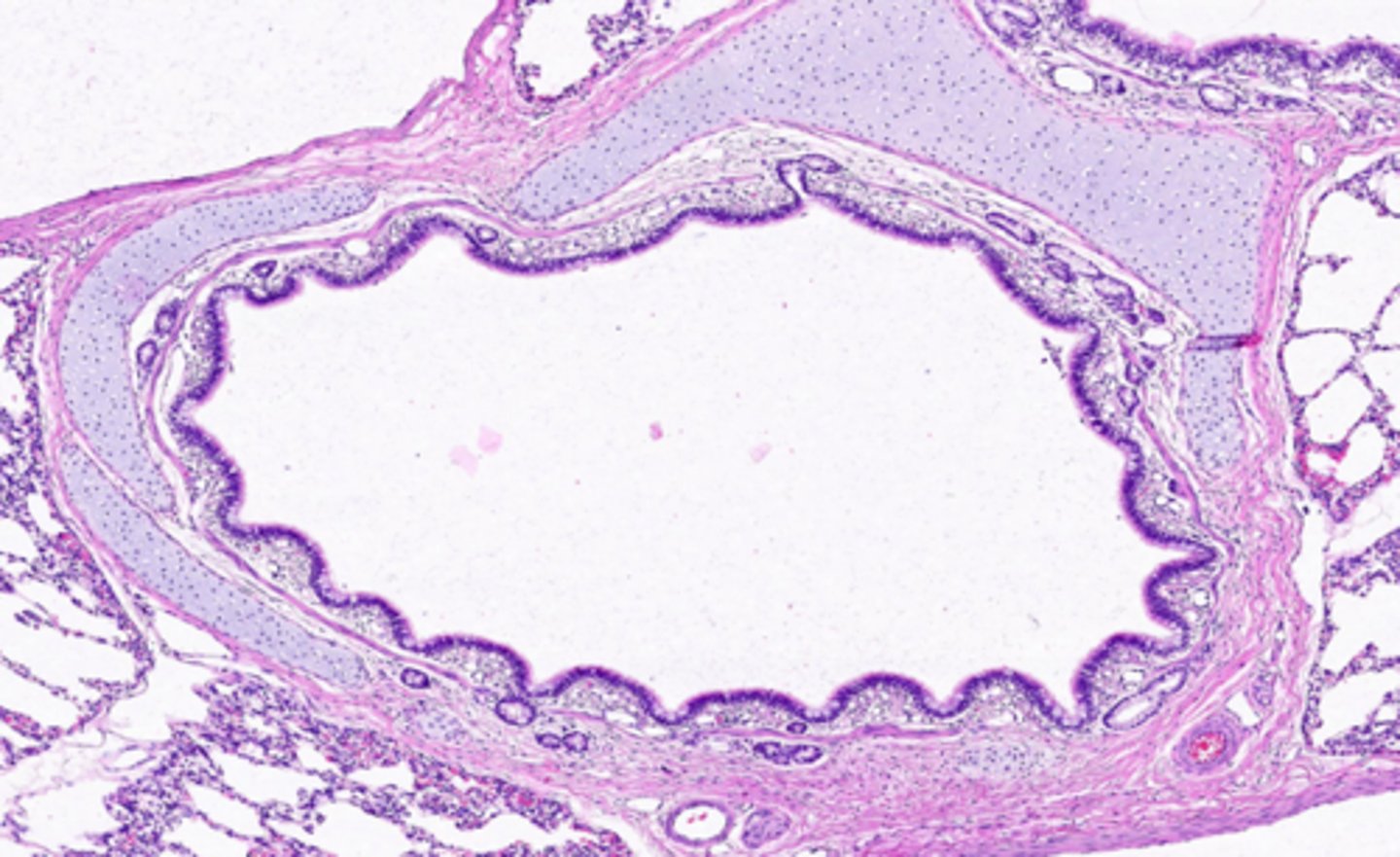 <p>ID the location of this slide:</p>