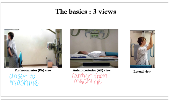 <ul><li><p>PA</p></li><li><p>AP</p></li><li><p>Lateral</p></li></ul><p></p>