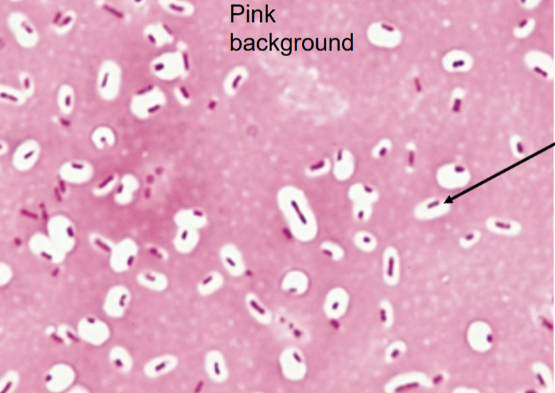 <p>What structure is highlighted in a capsule stain?<br></p>