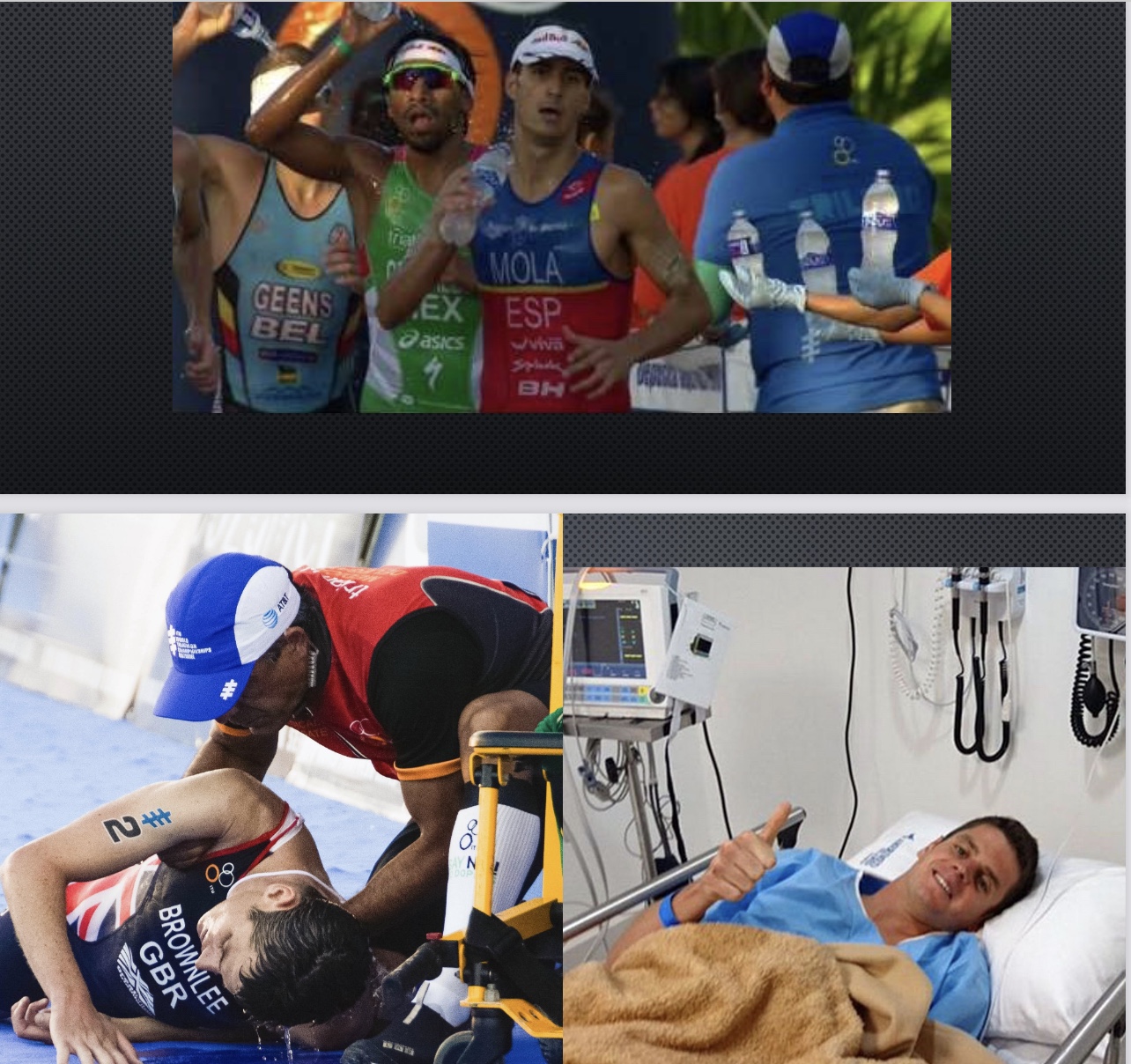 <p>-Dehydration</p><ul><li><p>So hot turned off ability to release heat</p></li><li><p>Competition for blood between skin (to dissipate heat) and muscle (for performance); low blood=bigger competition</p><ul><li><p>he skipped some aid stations</p></li></ul></li></ul><p>-Heat stroke</p><ul><li><p>push to point allow muscles to win</p></li><li><p>cook brain so lose consciousness</p></li></ul><p>-Depleted glycogen?</p><ul><li><p>but didn’t lose mental acuity w/ thks</p></li></ul><p>*produced a lot of heat (fastest metabolism of racers), did not rehydrate, and had low glycogen</p><p>*Interview: did not do heat training, thus was not heat adapted; genetically prone to heat injury? (ex: lower number of sweat glands)</p>