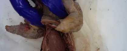 <p>Lower lobes of the lung</p>