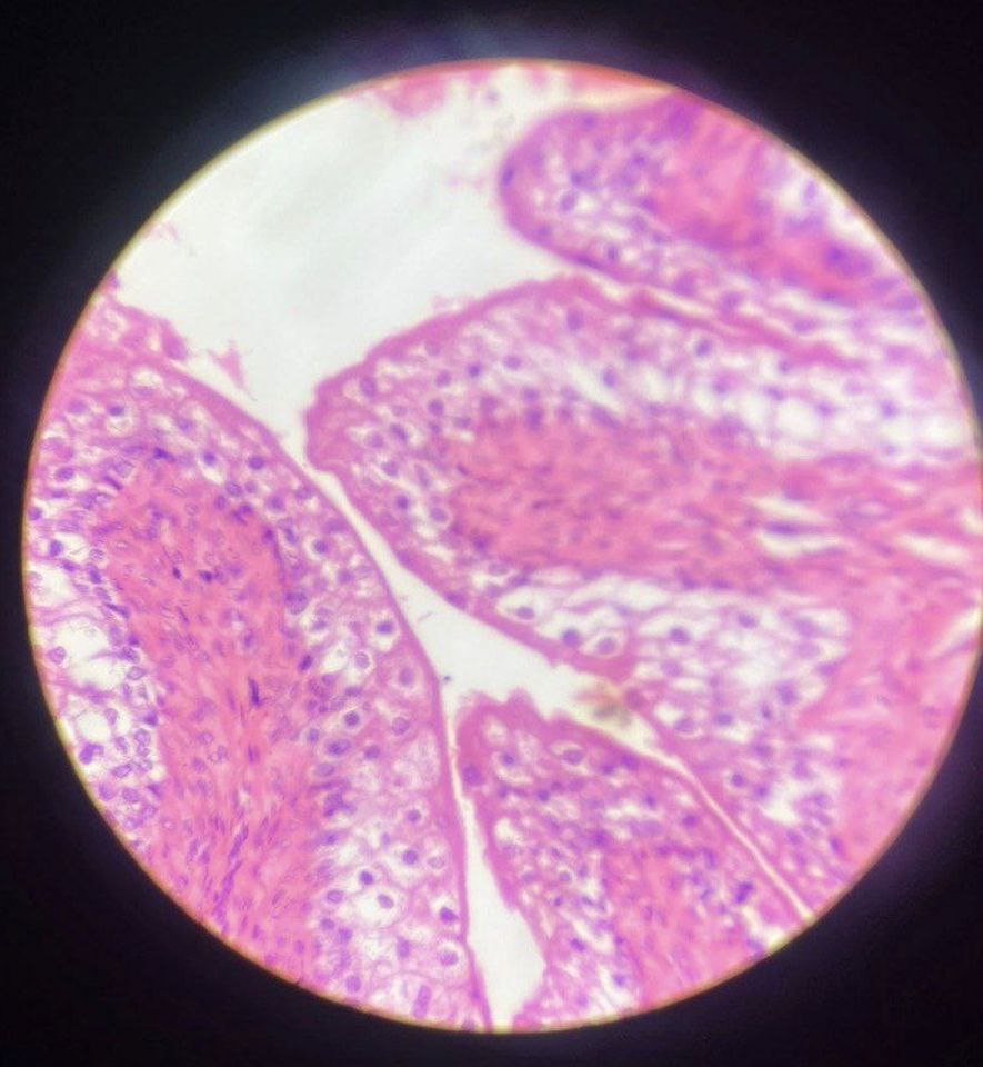 <p>Identify the tissue and mention one site</p>