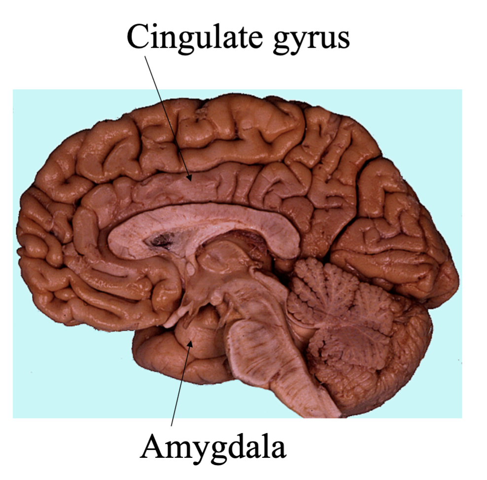 <ul><li><p>On the medial surface the parahippocampal gyrus is separated from the temporal lobe by the collateral sulcus.</p></li><li><p>The cingulate gyrus from the frontal and parietal lobes by the cingulate sulcus</p></li></ul><p></p>