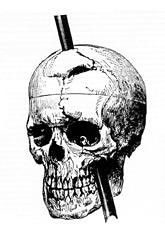 railroad worker who survived a severe brain injury that dramatically changed his personality and behavior; case played a role in the development of the understanding of the localization of brain function