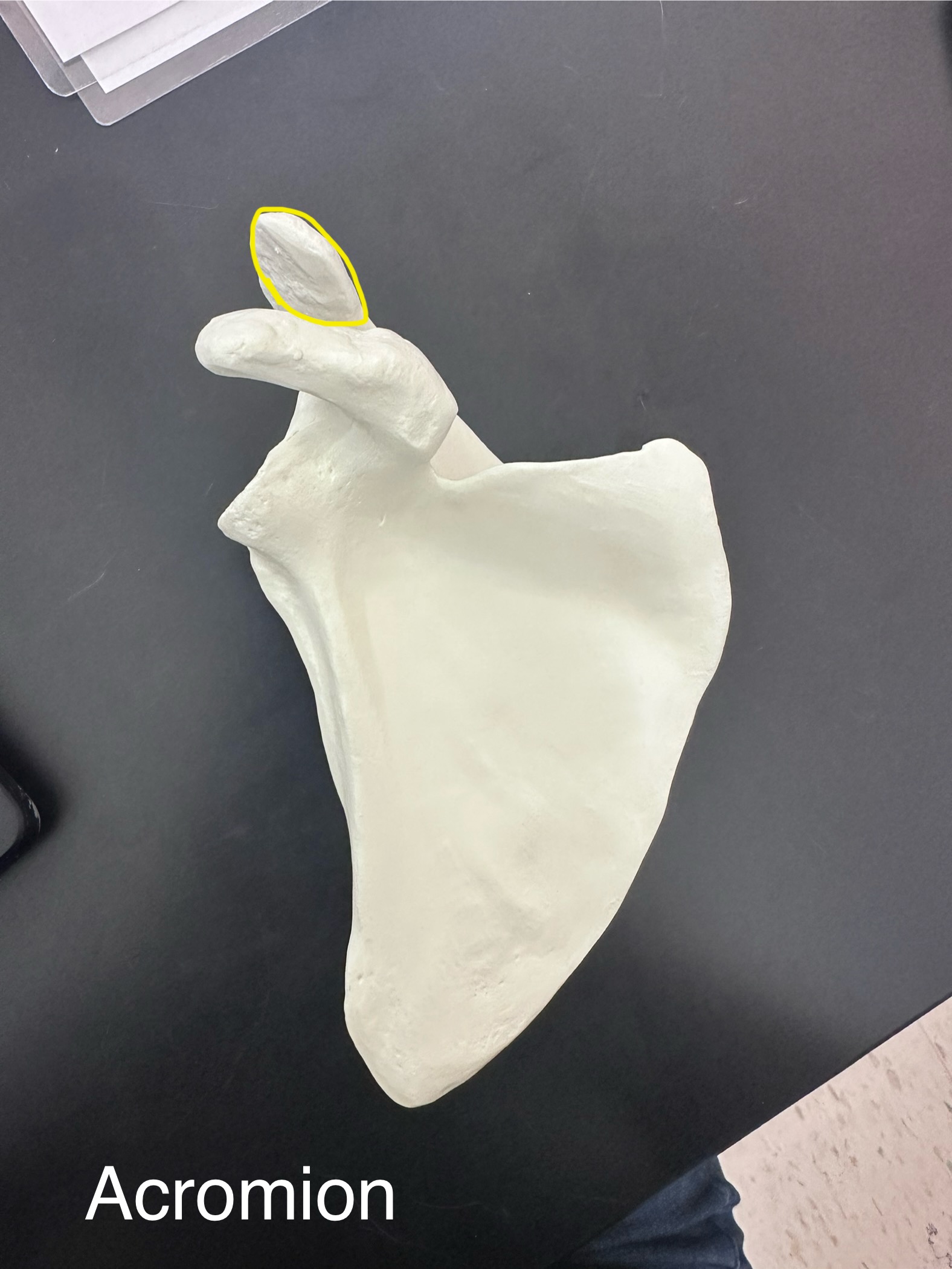 <p>Acromion of scapula</p>