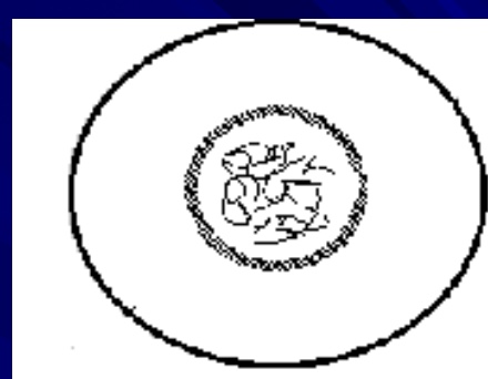 <p>what phase is this cell in&nbsp;</p>