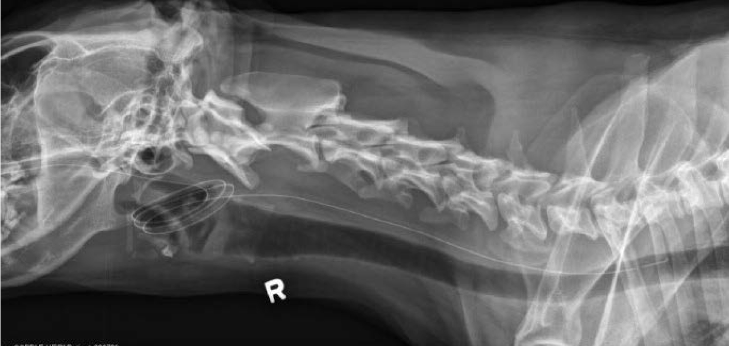 <p>What is the wrong with the NG tube in this radiograph?</p>