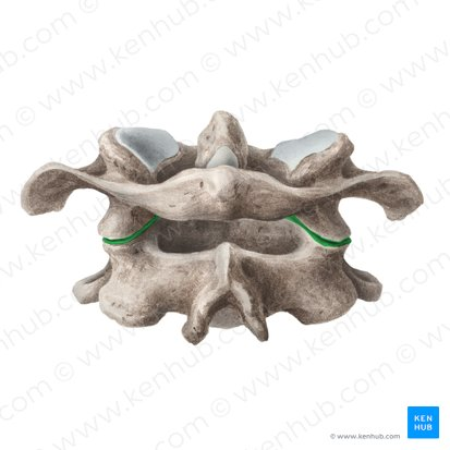 <p>What ligament is this</p>