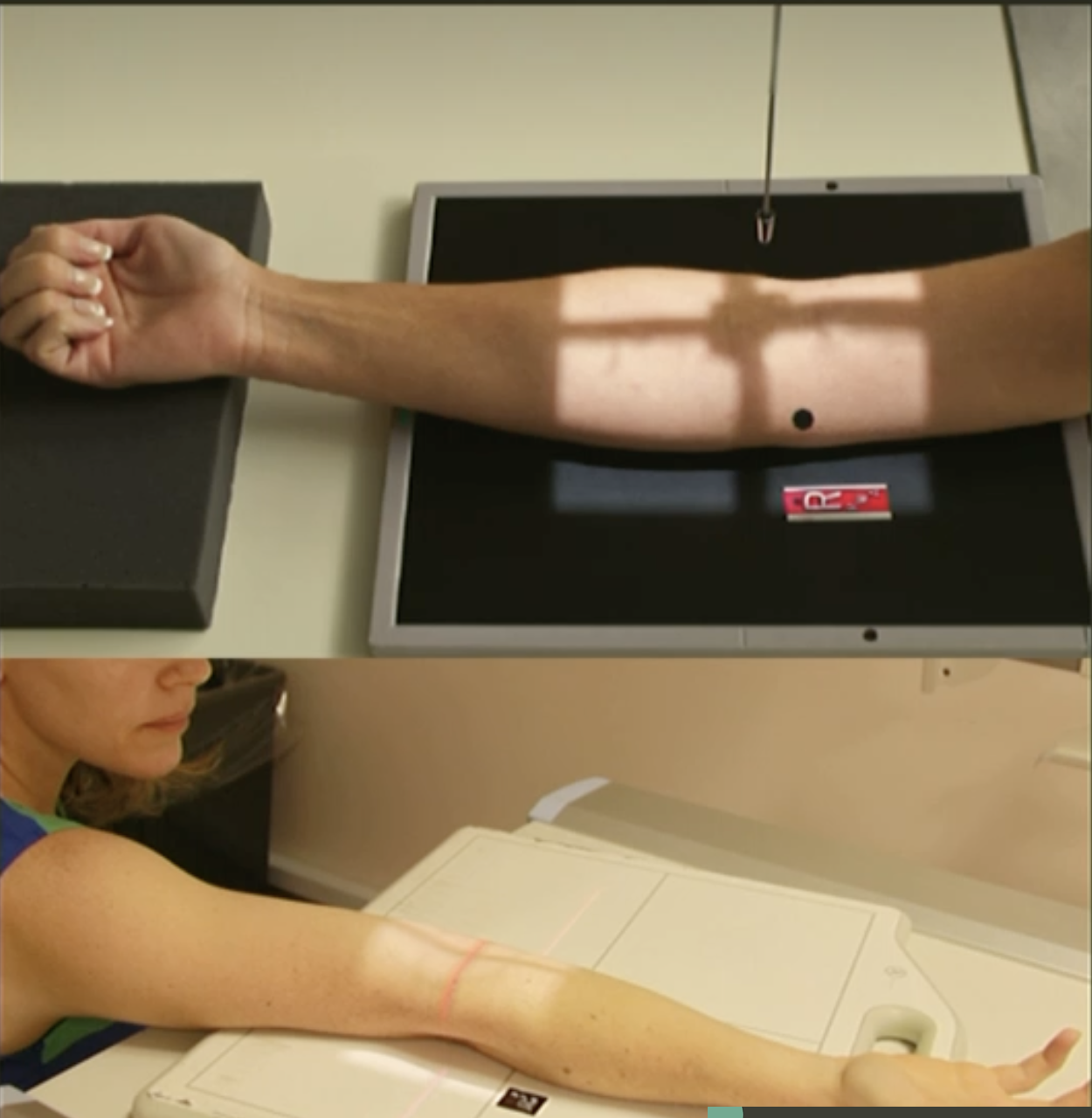 <p>Fine FS, 100cm</p><p>57kVp/2.5mAs</p><p>Straight tube</p><p>CR:&nbsp;Cubital fossa</p>