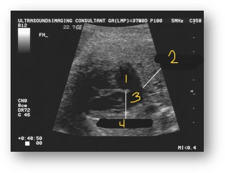 <p>Label this image</p>