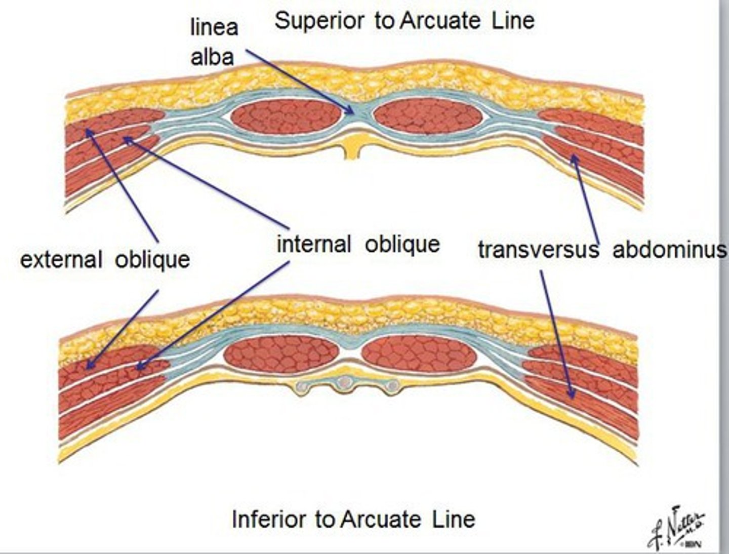 <p>1. External Oblique</p><p>2. Internal Oblique</p><p>3. Transversus Abdominis</p>