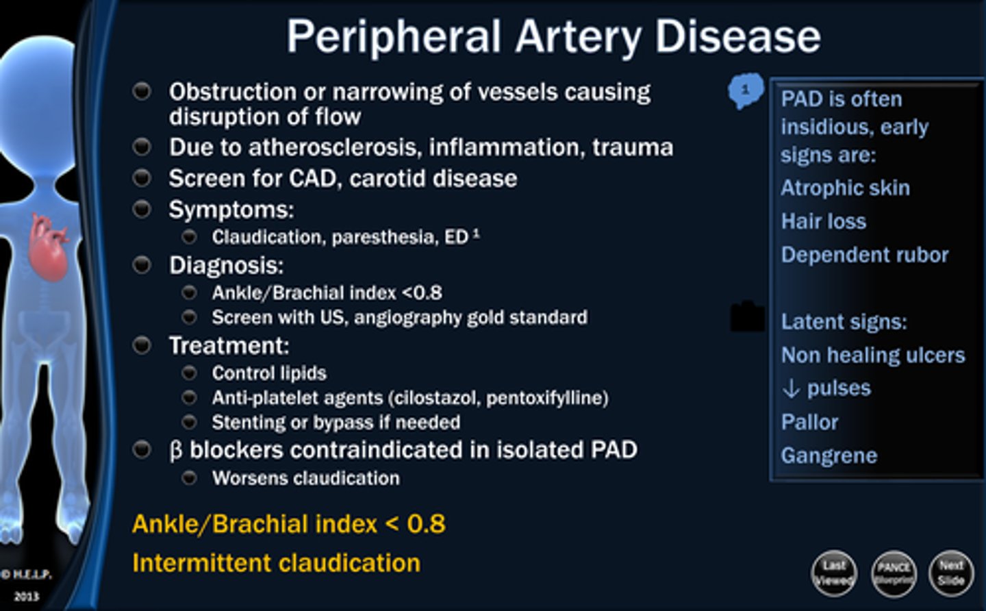 <p>Peripheral Artery Disease</p>