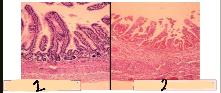 <p>What is this and What is the main feature of it?</p><p>Based on your observation,1 or 2 depicts a normal state of the intestinal wall?</p>