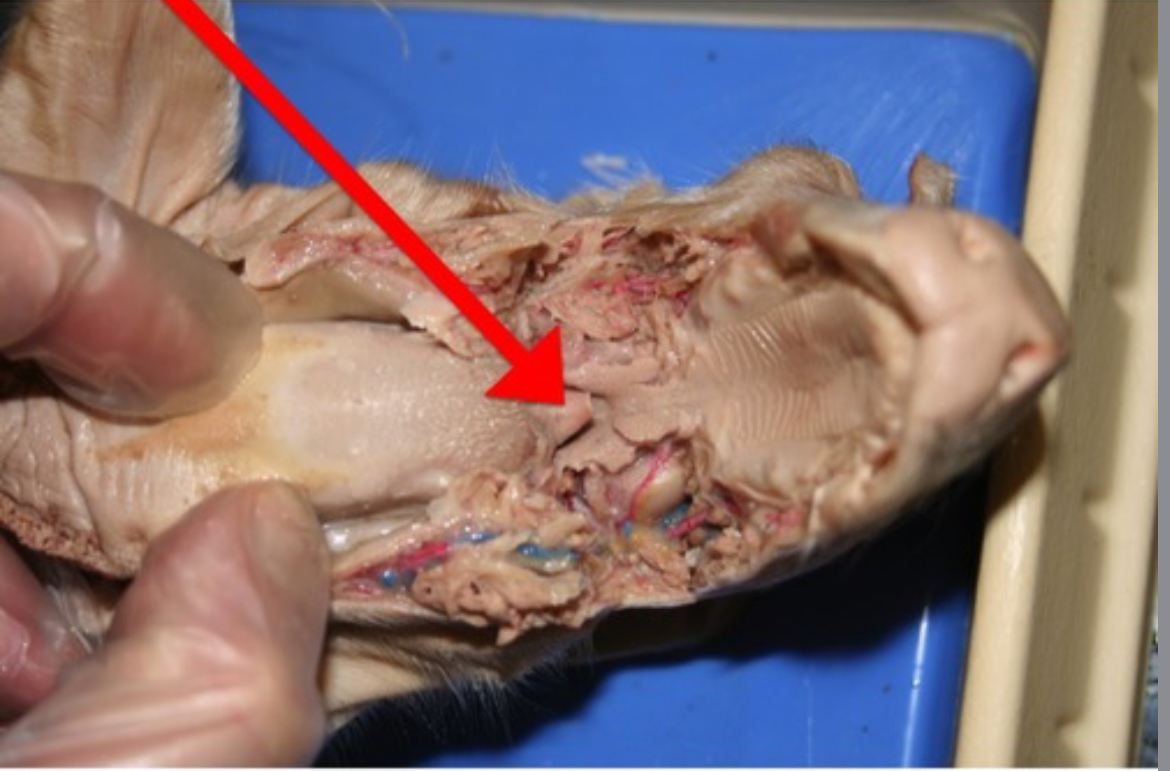 <p>Flap of tissue that covers the trachea during swallowing, preventing food from entering airways.</p>