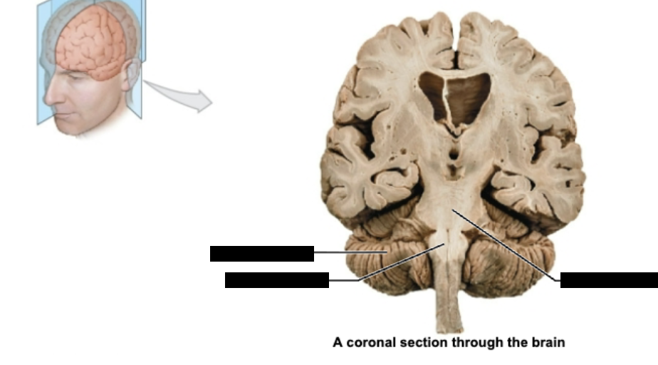 <p>label coronal section through brain</p>