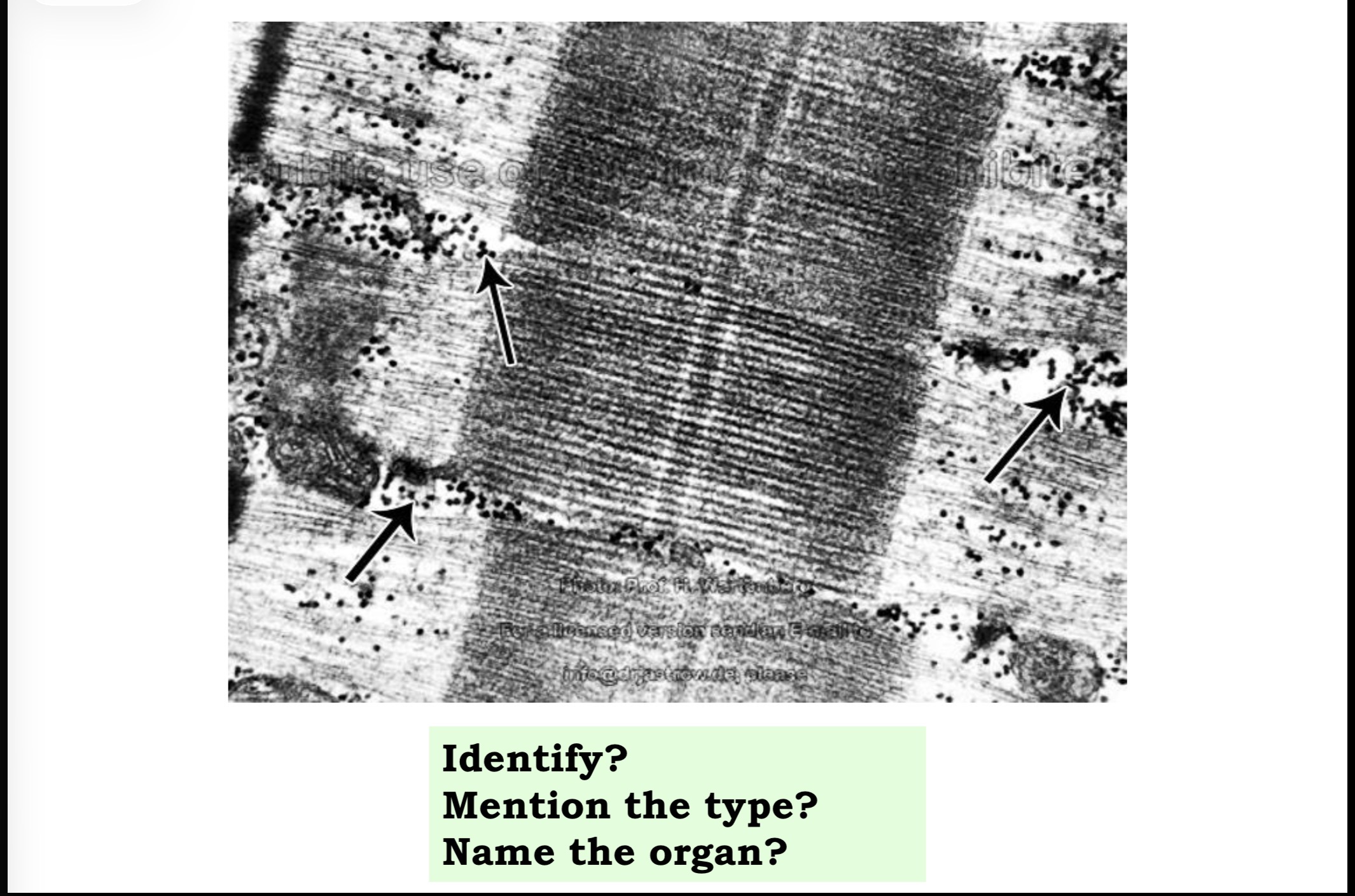 <p>Answer the questions in these following pictures </p>