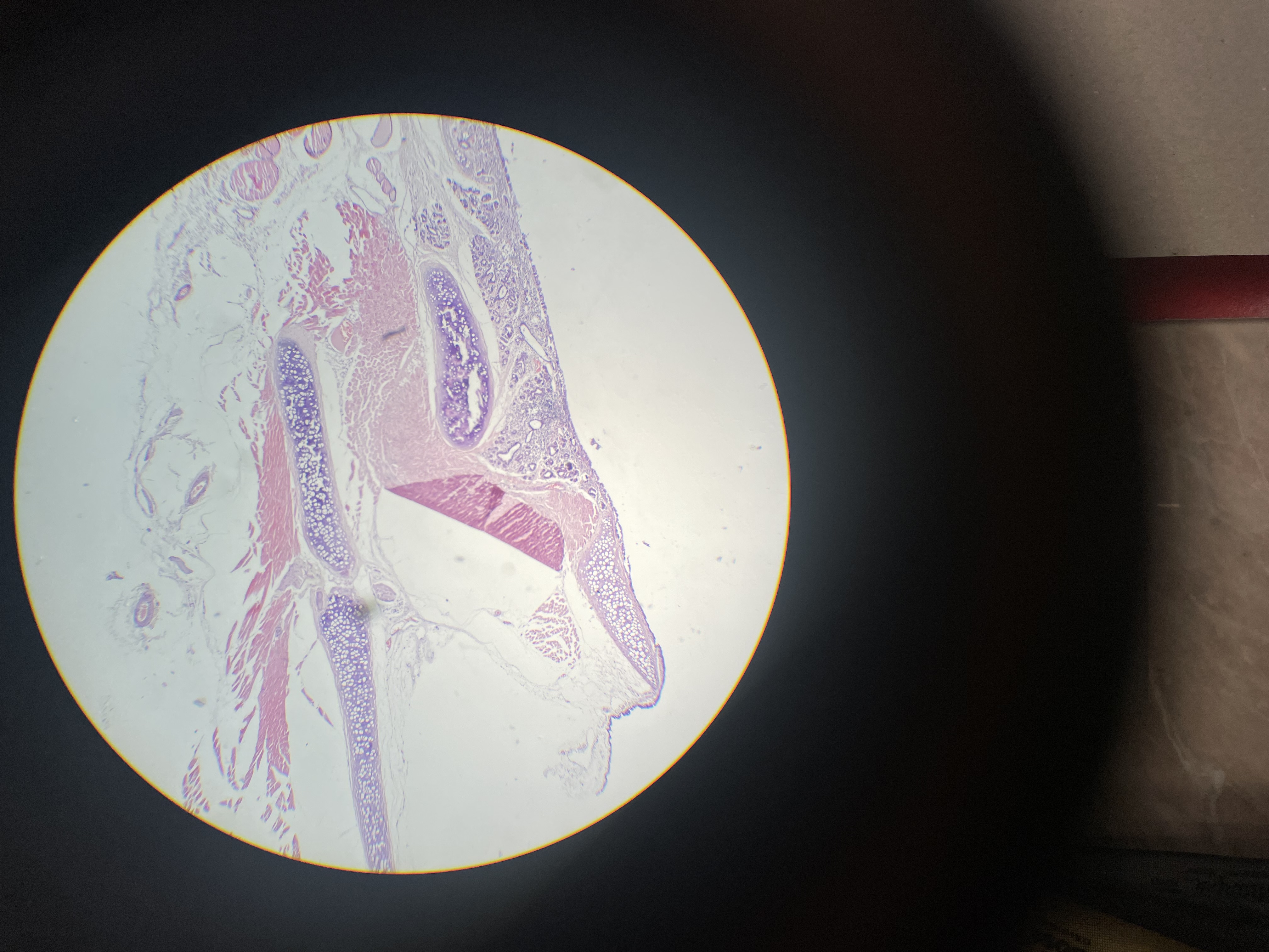 term image