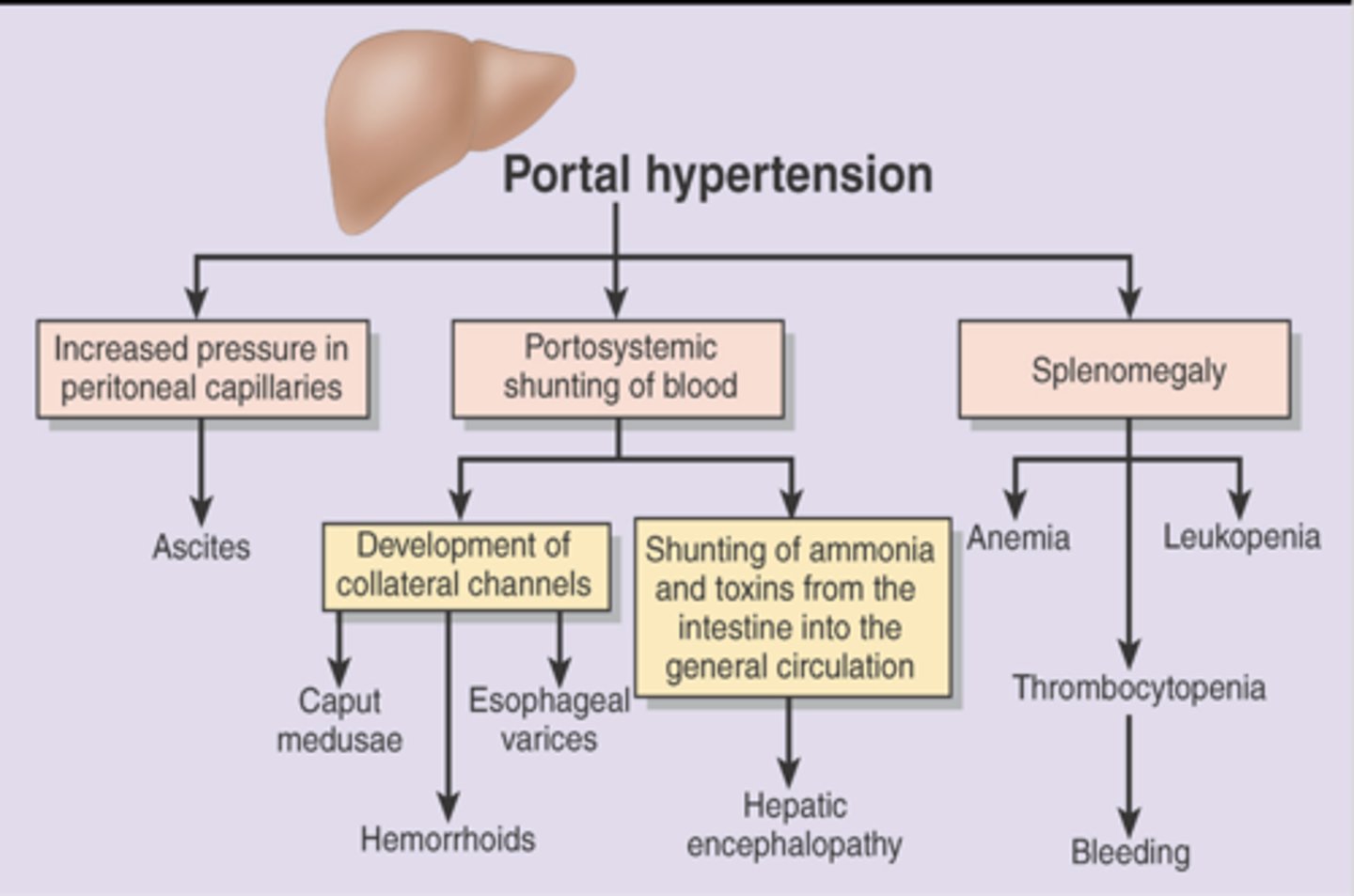 <p>Portal Hypertension Consequences</p>