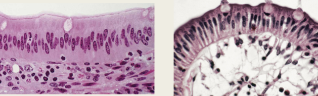 <p>Stomach and intestines</p><p>Single layer of cells, in columns.</p>