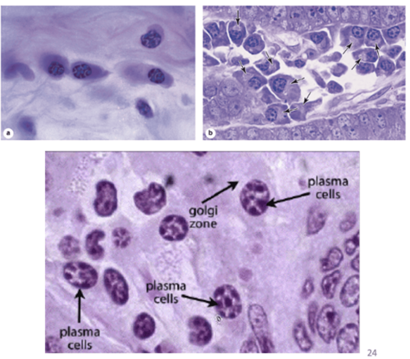 <p>Describe the nucleus of plasma cells.</p>