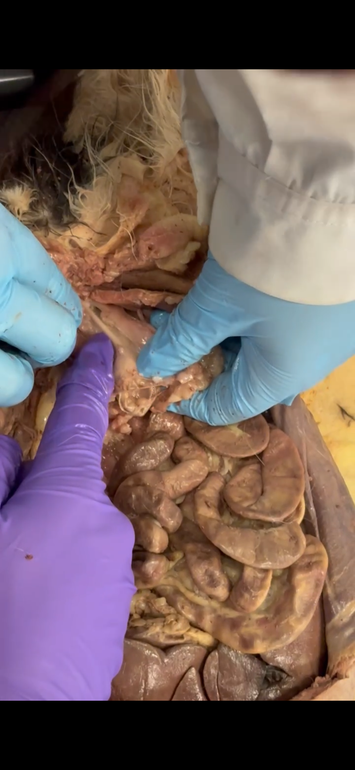 <p>Purple finger points to</p>