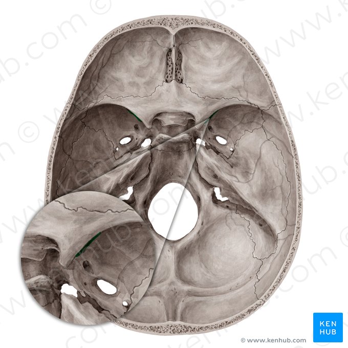 <p>průchod pro <strong><span style="color: yellow">III., IV., VI. hlavový nerv </span></strong><span style="color: yellow">(n. oculomotirus, trochlearis, abducens) a </span><strong><span style="color: yellow">V1</span></strong><span style="color: yellow"> (n. ophtalmicus) </span>a <strong><span style="color: blue">v. ophthalmica superior</span></strong></p><p>ústí do orbity</p>